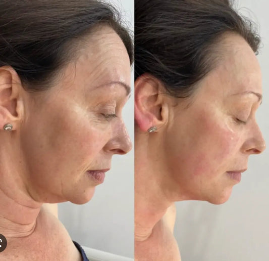 Anti-Aging HIFU, EMS and Microcurrent - Glide Goods LLC