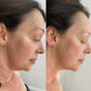 Anti-Aging HIFU, EMS and Microcurrent - Glide Goods LLC
