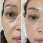 Anti-Aging HIFU, EMS and Microcurrent - Glide Goods LLC