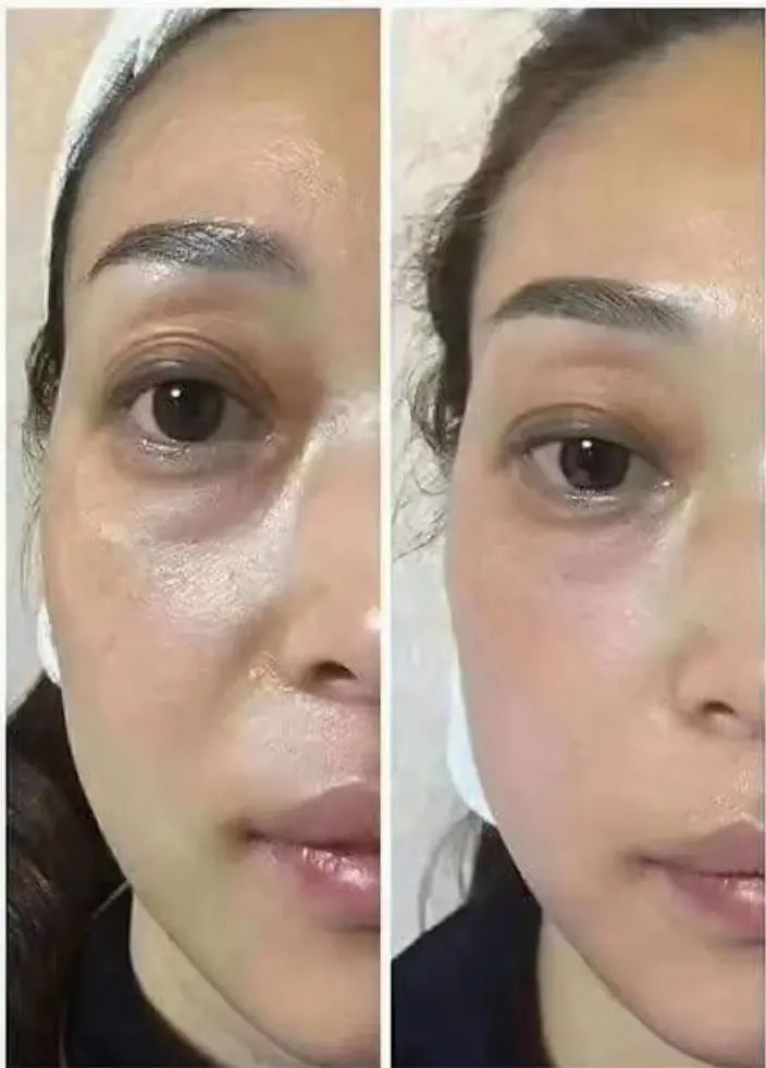 Anti-Aging HIFU, EMS and Microcurrent - Glide Goods LLC