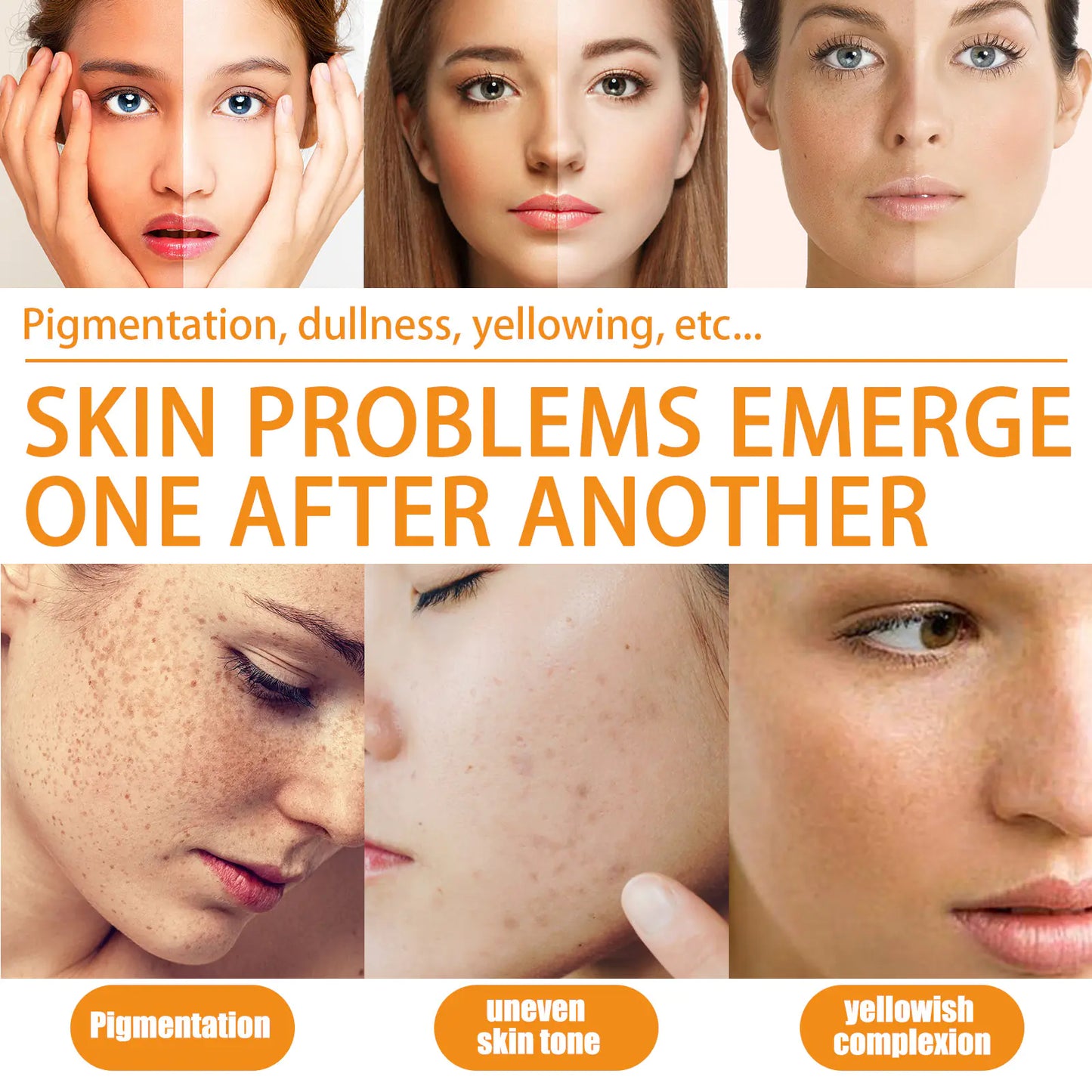 West&Month VC Skin Brightening Essence for Radiance