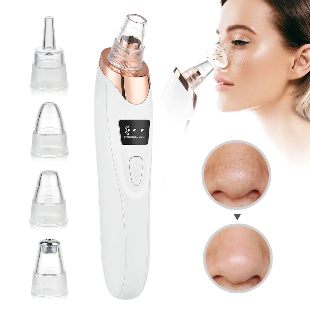 Beauty Electric Blackhead Remover - Glide Goods LLC