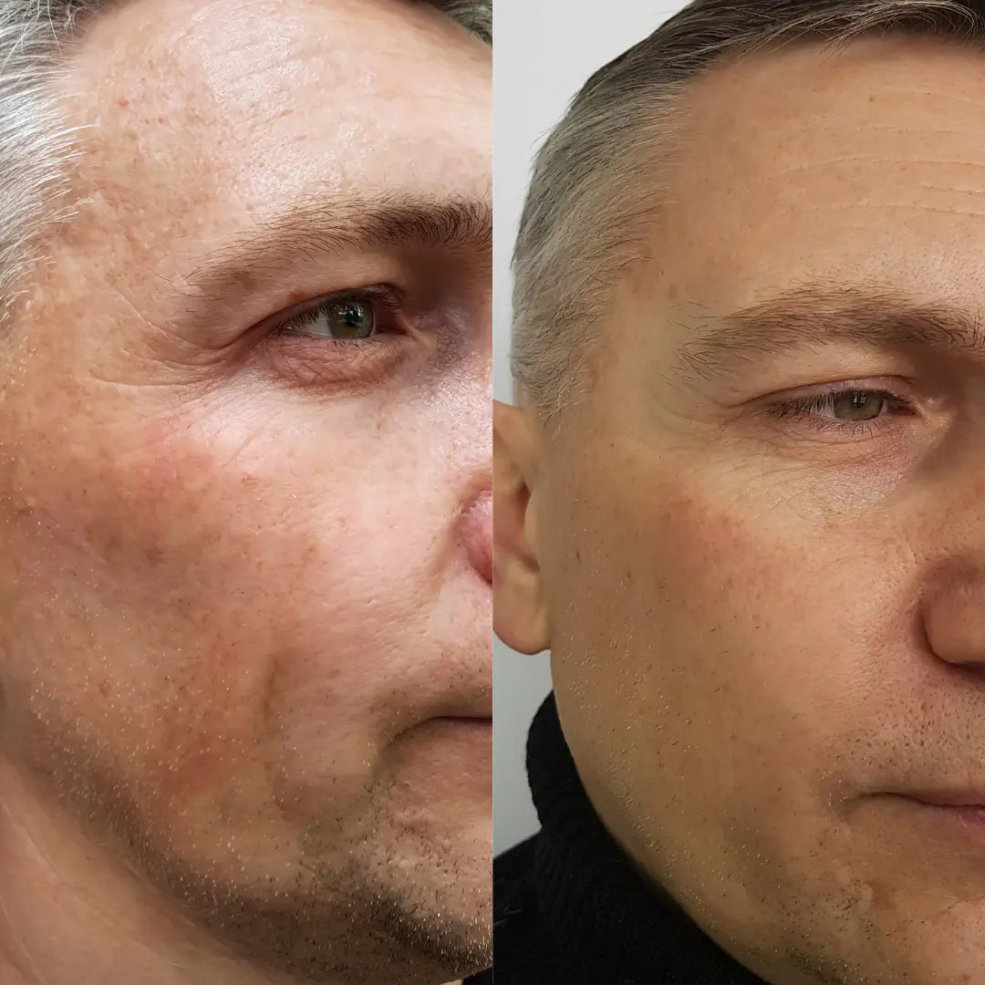 Anti-Aging HIFU, EMS and Microcurrent - Glide Goods LLC