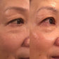 Anti-Aging HIFU, EMS and Microcurrent - Glide Goods LLC