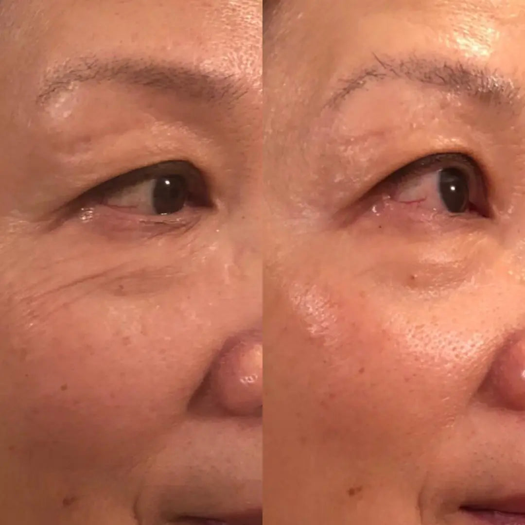 Anti-Aging HIFU, EMS and Microcurrent - Glide Goods LLC