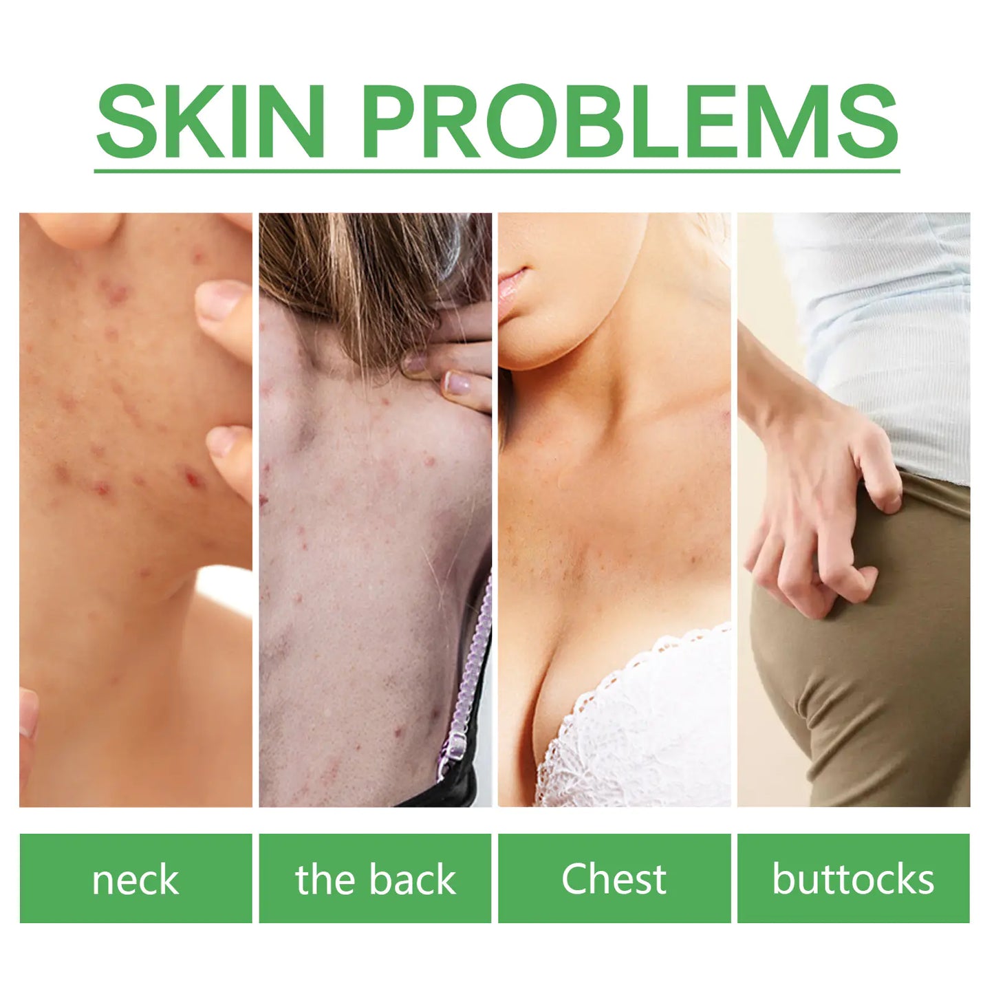 Jaysuing Acne Spot Lightening Serum for Skin Care