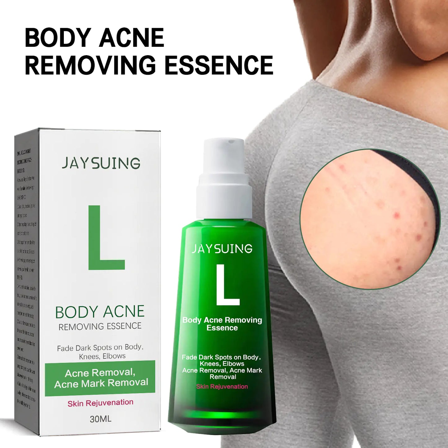 Jaysuing Acne Spot Lightening Serum for Skin Care