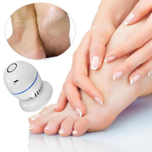 Portable Vacuum Callus Remover - Glide Goods LLC