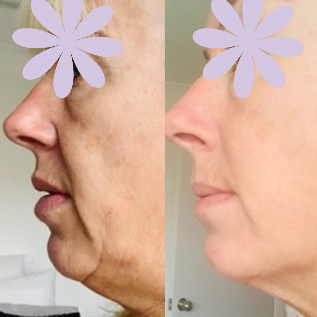 Anti-Aging HIFU, EMS and Microcurrent - Glide Goods LLC