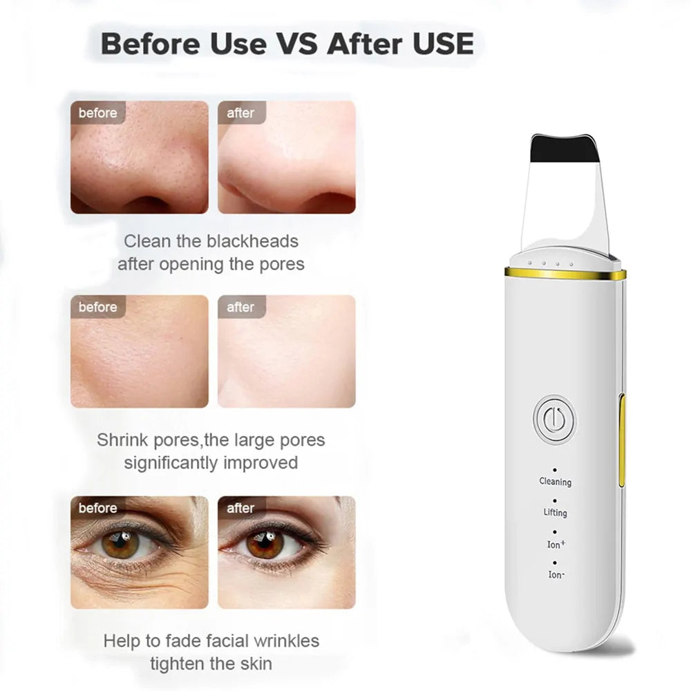 Beauty Ultrasonic Skin Scrubber - Glide Goods LLC