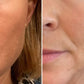 Anti-Aging HIFU, EMS and Microcurrent - Glide Goods LLC