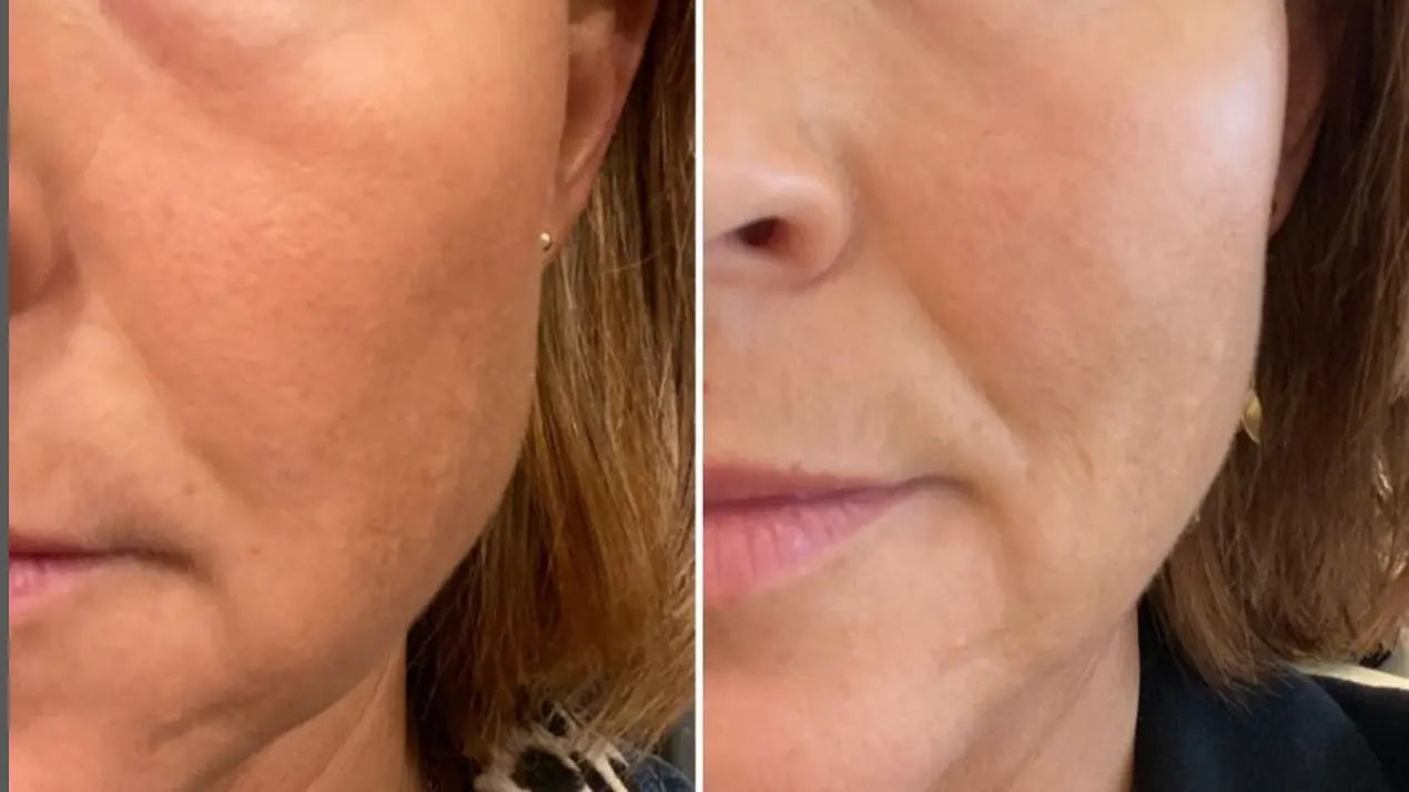 Anti-Aging HIFU, EMS and Microcurrent - Glide Goods LLC