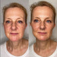 Anti-Aging HIFU, EMS and Microcurrent - Glide Goods LLC