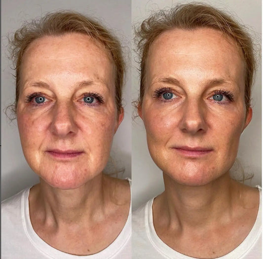 Anti-Aging HIFU, EMS and Microcurrent - Glide Goods LLC