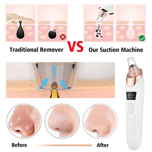 Beauty Electric Blackhead Remover - Glide Goods LLC