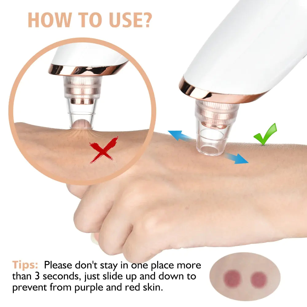 Beauty Electric Blackhead Remover - Glide Goods LLC